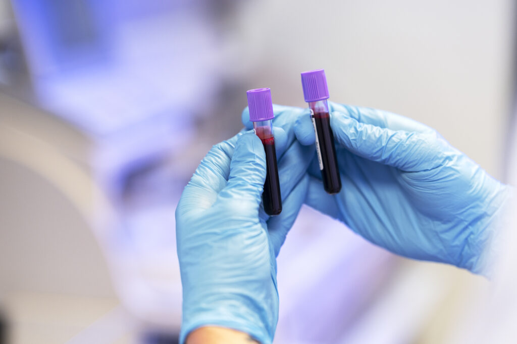 Mobile Phlebotomists: Improving Access and Convenience in Healthcare Mobile Phlebotomist Jobs Opportunities